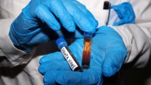 Hantavirus detectado en un turista de paso por Francia: lo que sabemos